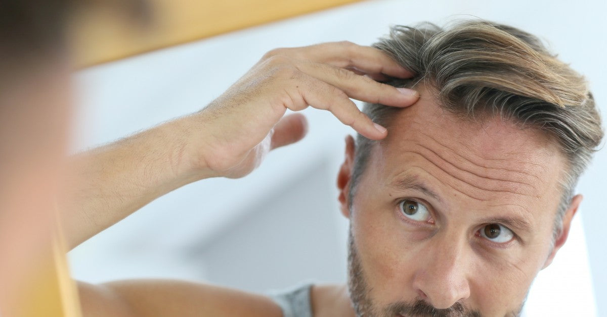 What Are My Options For Hair Loss Treatments?